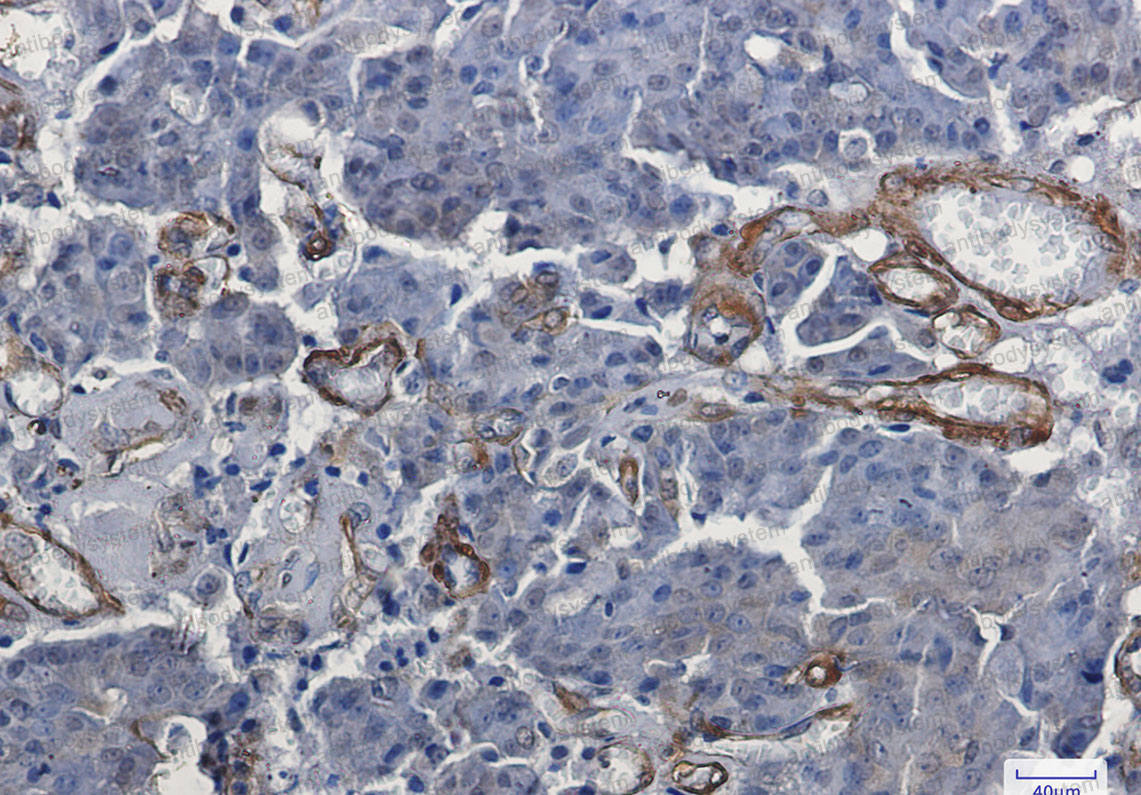 Anti-VCL Antibody (R1Q82)