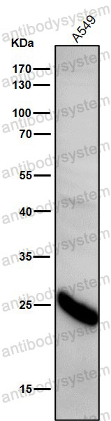 Anti-GPX2 Antibody (R1Q83)
