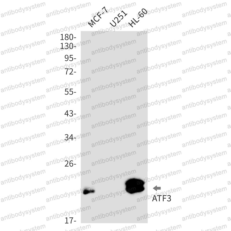 Anti-ATF3 Antibody (R1Q97)