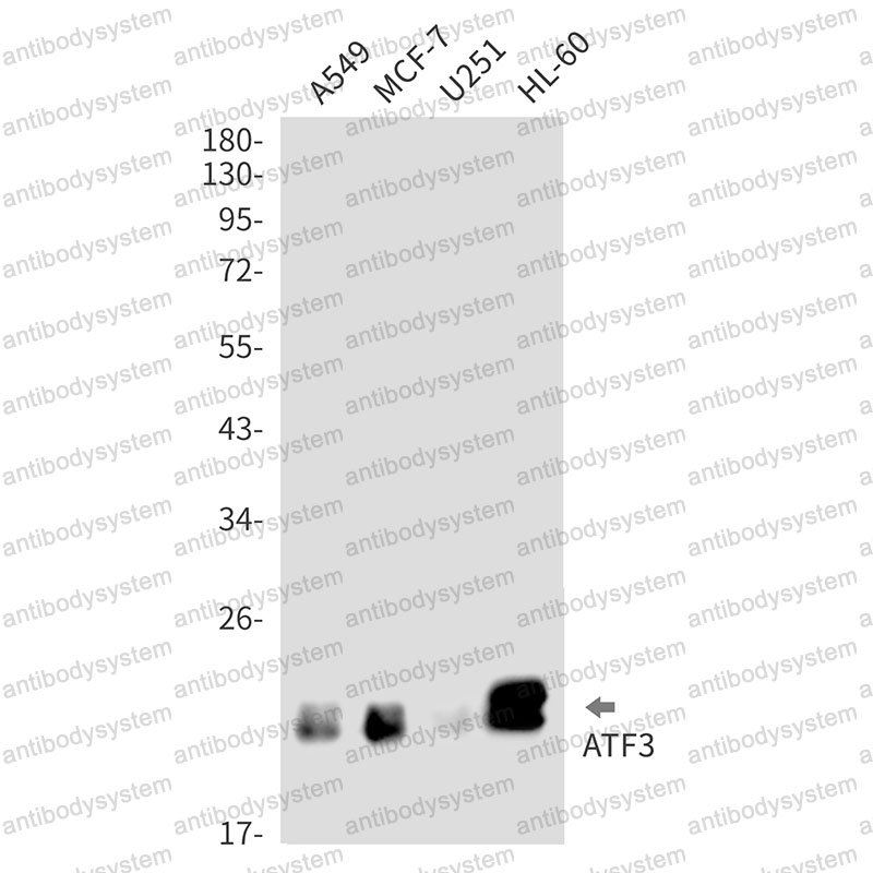 Anti-ATF3 Antibody (R1Q96)