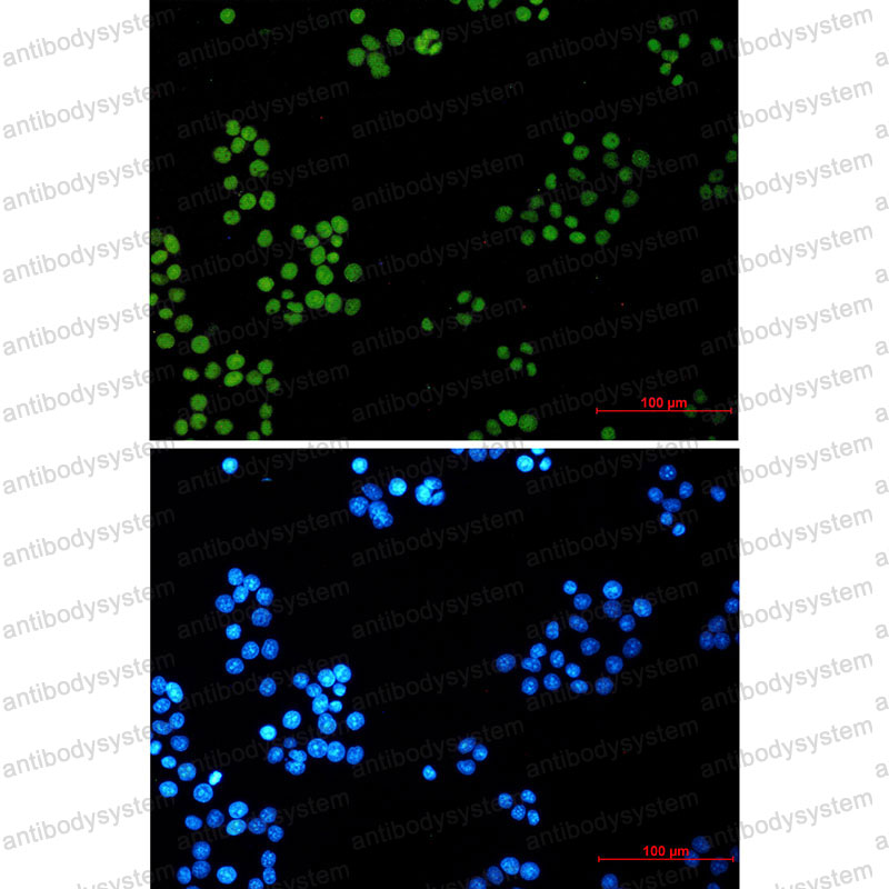 Anti-LIG1 Antibody (R1R01)