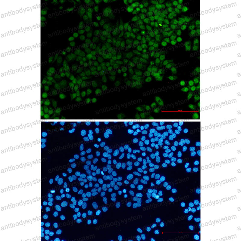 Anti-XRCC1 Antibody (R1R02)
