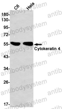 Anti-KRT4 Antibody (R1R05)