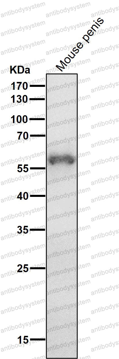 Anti-KRT4 Antibody (R1R03)