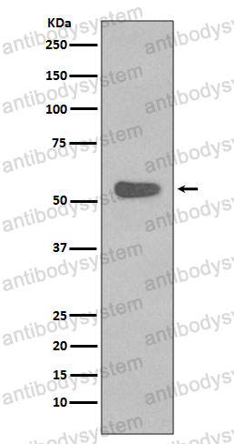 Anti-KRT4 Antibody (R1R04)