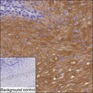 Immunohistochemical for Anti-KRT4 Antibody (R3F11) ?>