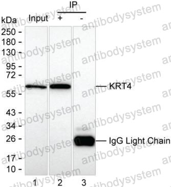 Immunoprecipitation for Anti-KRT4 Antibody (R3F11) ?>