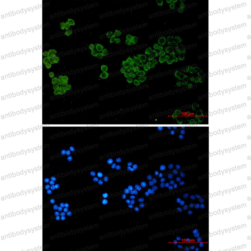 Anti-PLCG1 Antibody (R1R07)