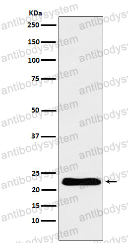 Anti-TNNI1 Antibody (R1R08)