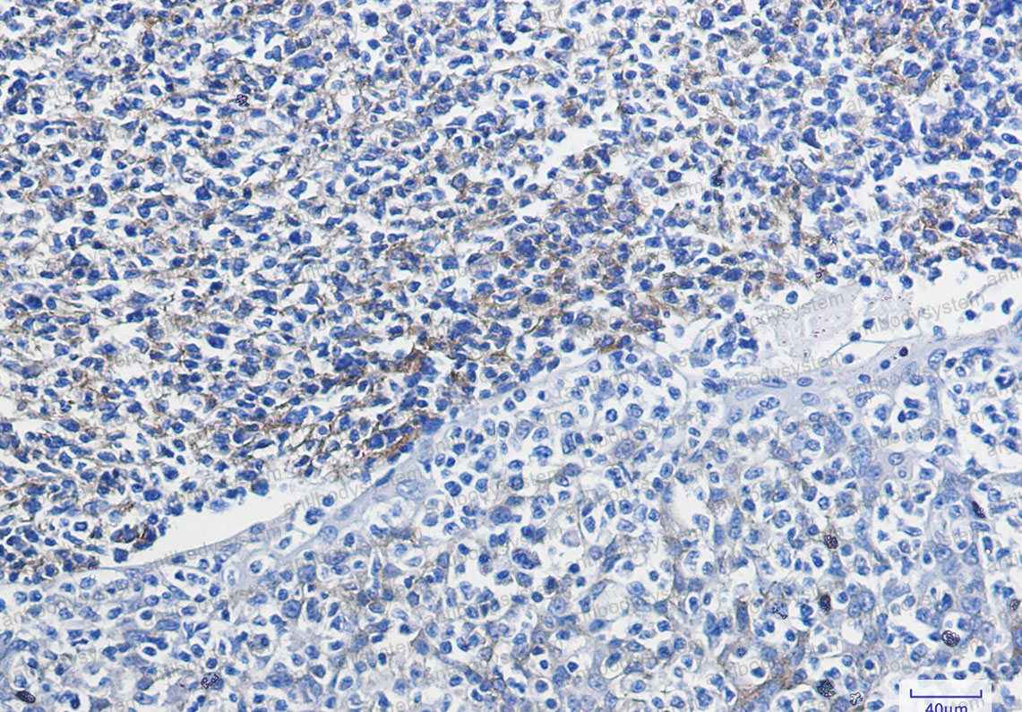 Anti-CD106/VCAM1 Antibody (R1R10)