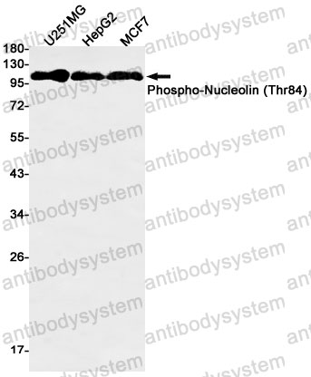 Anti-Phospho-NCL/Nucleolin (Thr84) Antibody (R1R16)