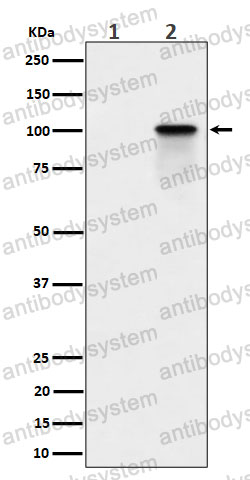 Anti-Phospho-NCL/Nucleolin (T84) Antibody (R1R14)