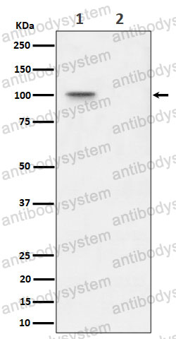 Anti-Phospho-NCL/Nucleolin (T76) Antibody (R1R15)