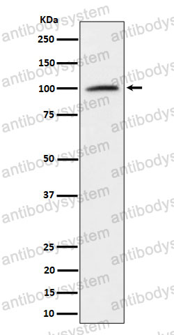 Anti-NCL Antibody (R1R12)