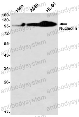 Anti-NCL Antibody (R1R17)