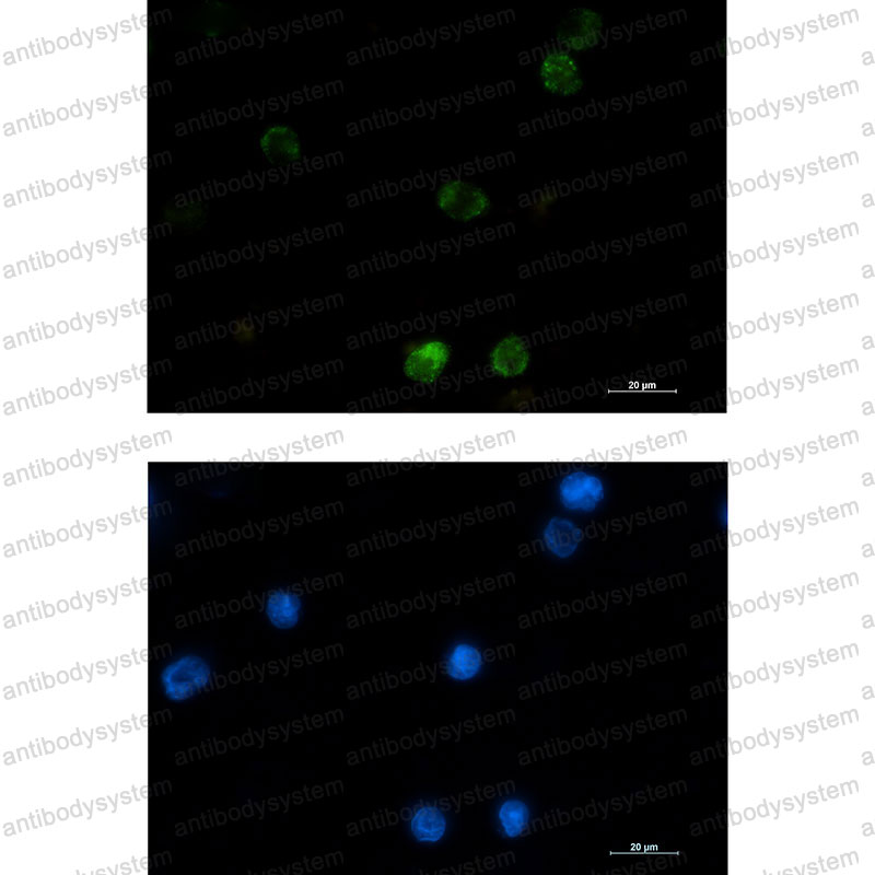 Anti-HK1 Antibody (R1R18)
