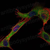 Immunofluorescence for Anti-HK1 Antibody (R3F23) ?>