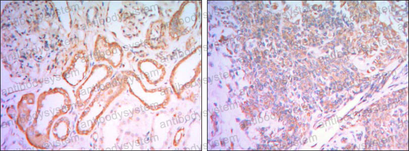 Immunohistochemical for Anti-HK1 Antibody (R3F23) ?>