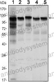 Western blot for Anti-HK1 Antibody (R3F23) ?>