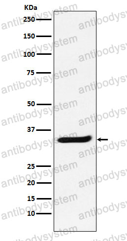 Anti-POLR2C Antibody (R1R19)