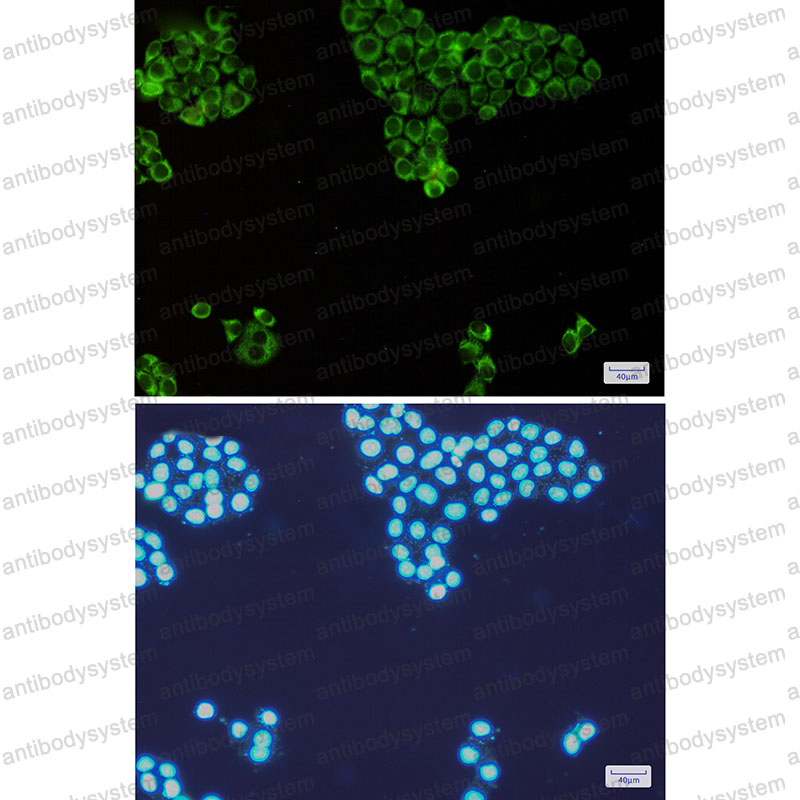 Anti-EIF2AK2 Antibody (R1R26)