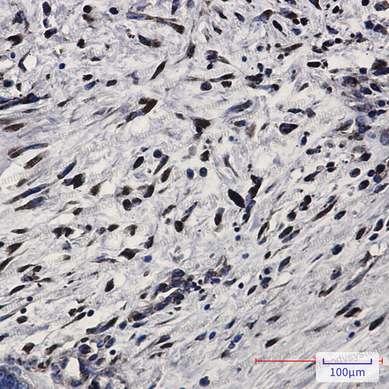 Immunohistochemical for Anti-EIF2AK2 Antibody (R1R26) ?>