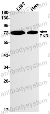 Western blot for Anti-EIF2AK2 Antibody (R1R26) ?>