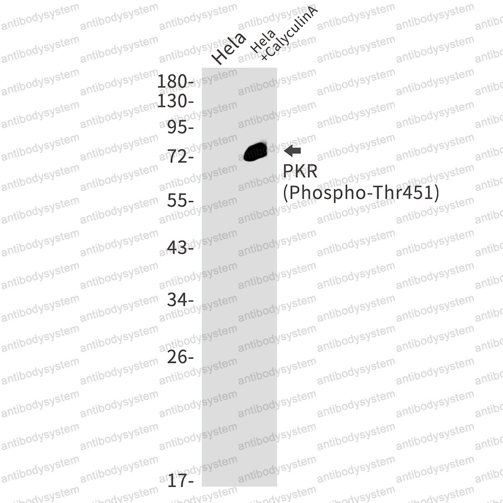 Anti-Phospho-EIF2AK2/PKR (Thr451) Antibody (R1R25)