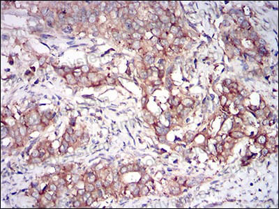 Immunohistochemical for Anti-EIF2AK2 Antibody (R3F38) ?>