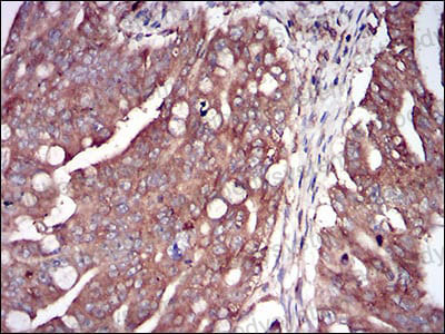Immunohistochemical for Anti-EIF2AK2 Antibody (R3F38) ?>