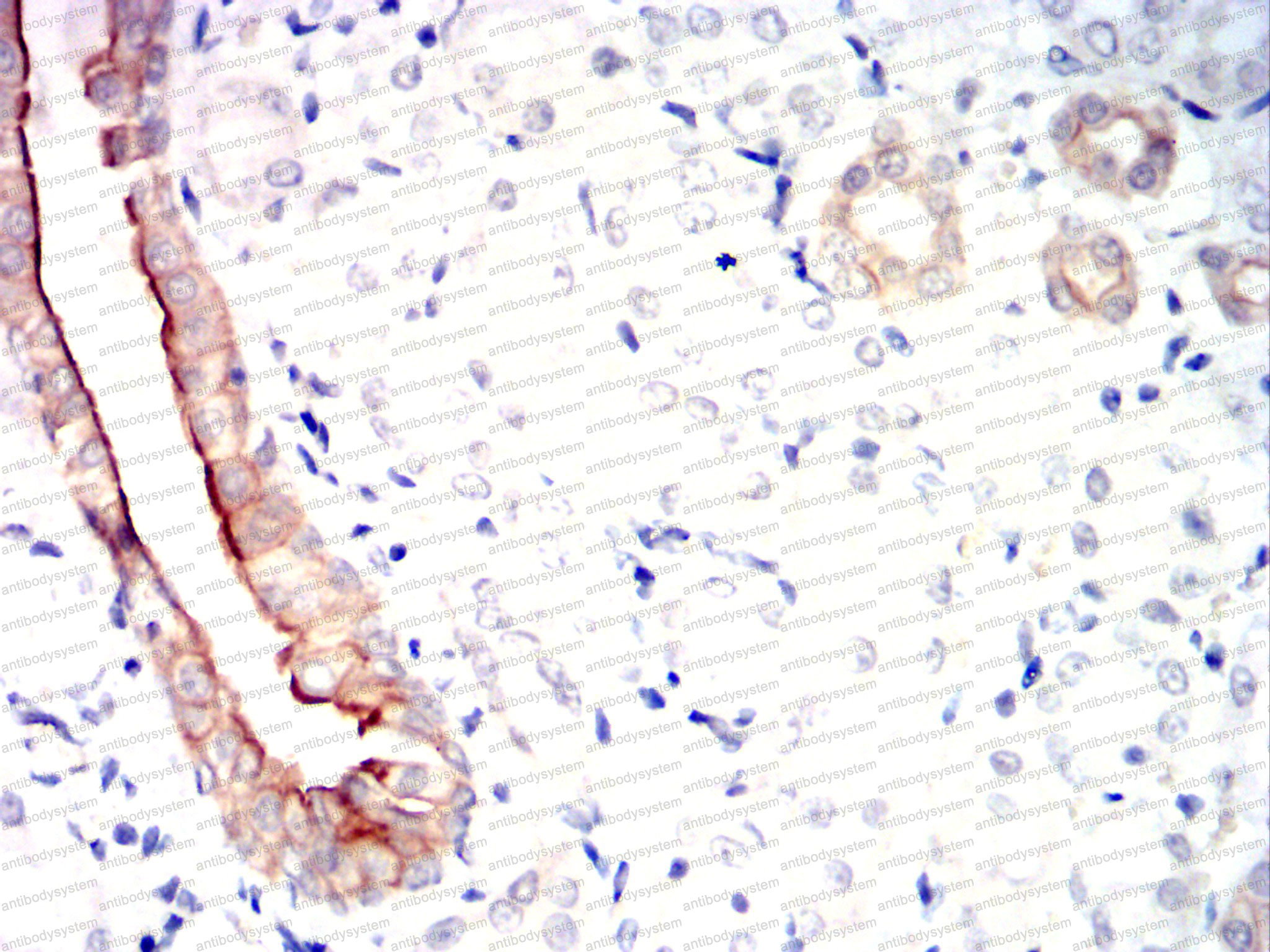 Immunohistochemical for Anti-EIF2AK2 Antibody (R3F38) ?>