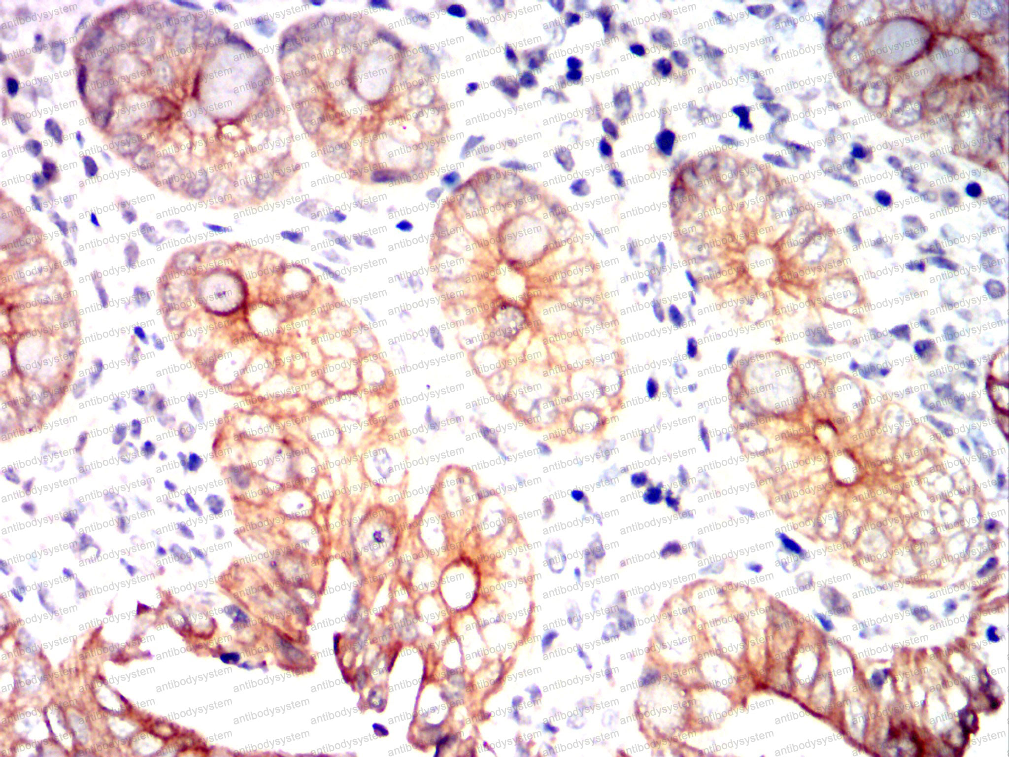 Immunohistochemical for Anti-EIF2AK2 Antibody (R3F38) ?>