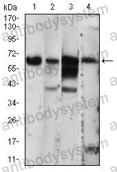 Western blot for Anti-EIF2AK2 Antibody (R3F38) ?>