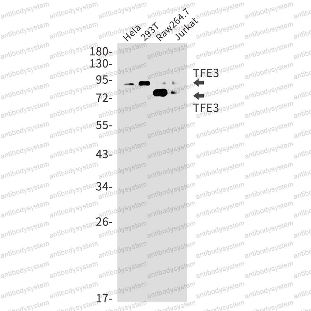 Anti-TFE3 Antibody (R1R29)