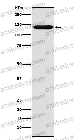 Anti-SLC9A1 Antibody (R1R30)