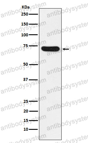 Anti-NOXA2/p67phox Antibody (R1R33)