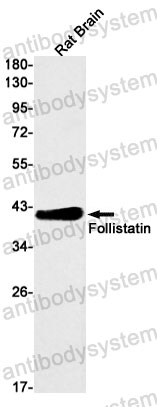 Anti-FST/Follistatin Antibody (R1R35)