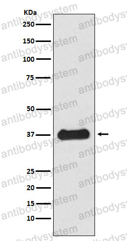 Anti-FST/Follistatin Antibody (R1R34)