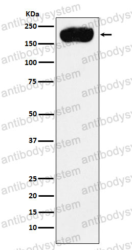 Anti-ATP2B1 Antibody (R1R36)