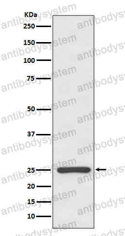 Anti-Human Kappa light chain Antibody (R1R38)