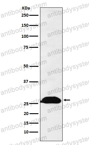Anti-Human Kappa light chain Antibody (R1R39)