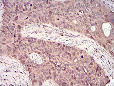 Immunohistochemical for Anti-CCNA2 Antibody (R3F57) ?>