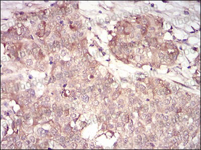 Immunohistochemical for Anti-CCNA2 Antibody (R3F57) ?>