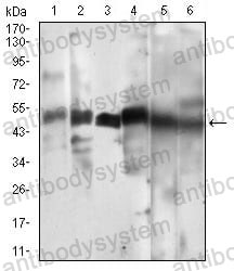 Western blot for Anti-CCNA2 Antibody (R3F57) ?>