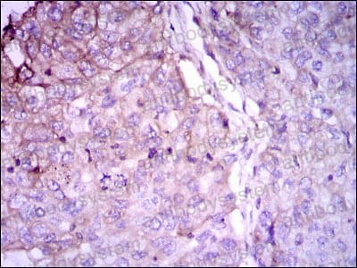 Immunohistochemical for Anti-RAB4A Antibody (R3F68) ?>
