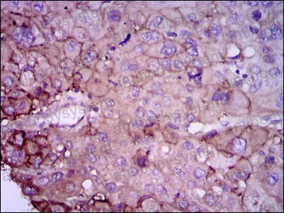 Immunohistochemical for Anti-RAB4A Antibody (R3F68) ?>