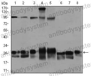 Western blot for Anti-RAB4A Antibody (R3F68) ?>