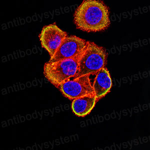 Immunofluorescence for Anti-M6PR Antibody (R3F73) ?>