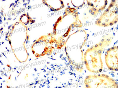 Immunohistochemical for Anti-M6PR Antibody (R3F73) ?>