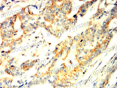Immunohistochemical for Anti-M6PR Antibody (R3F73) ?>